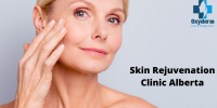 Radio Frequency for Skin Treatment in Edmonton | Oxyderm laser clinic | CatchFree.ca